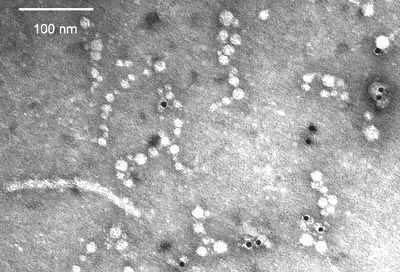 Le virus de la paratyphose Le virus de la paratyphose